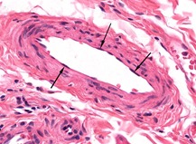Alvéolos pulmonares