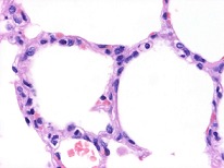 Alvéolos pulmonares